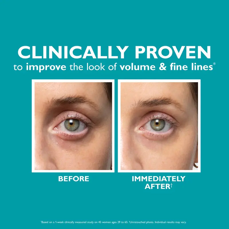 ✨LOVILDS™ Skinjection Fill+Fix Under-Eye Cream. Target Dark Circles, Puffiness & Fine Lines for a Youthful, Radiant Look