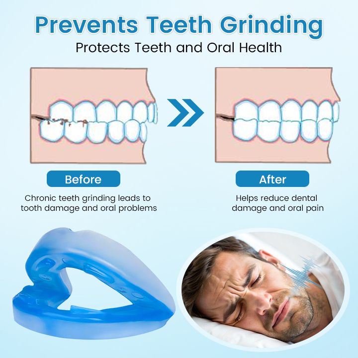 🌙 SILENT NIGHTS, STRONG TEETH! 🦷 QIAWI™ Anti-Snoring Guard 🔵✨