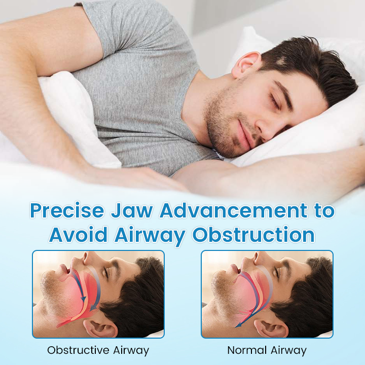 🌙 SILENT NIGHTS, STRONG TEETH! 🦷 QIAWI™ Anti-Snoring Guard 🔵✨