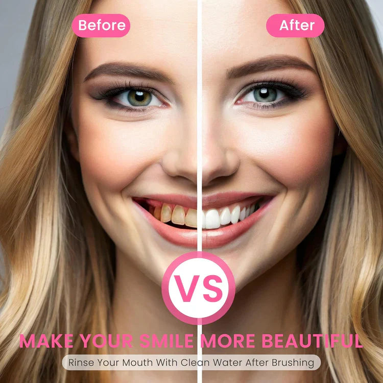 šćMaxć NewyuoĀ® Nicotinamide ToothpastećNew upgrade Powerful type 10% concentration of Nicotinamideć