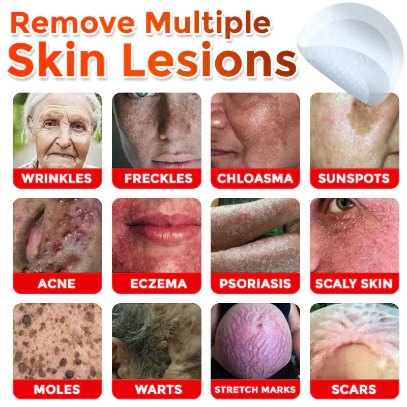 đLOVILDSÂź MicroNeedle Botanic Skin Tag Removal Patch (Made in the USA)