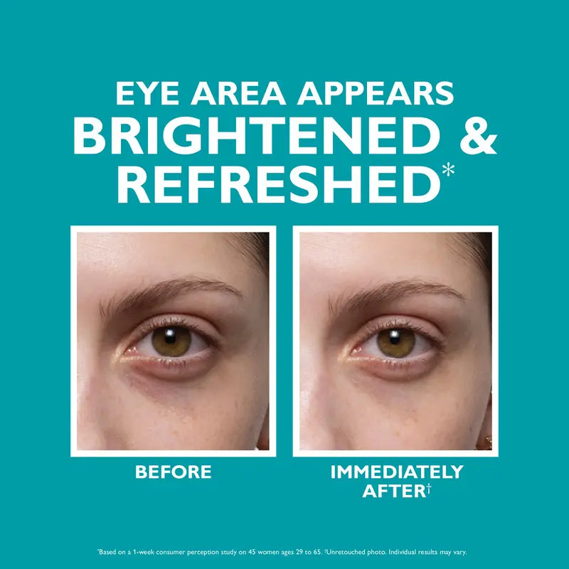 ✨LOVILDS™ Skinjection Fill+Fix Under-Eye Cream. Target Dark Circles, Puffiness & Fine Lines for a Youthful, Radiant Look