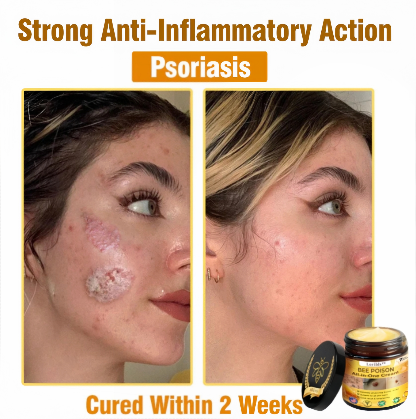 [Official Brand Store] 🏆Lovilds™ BEE POISON All-in-One Cream (✅FDA Approved & Mayo Clinic Recommended)