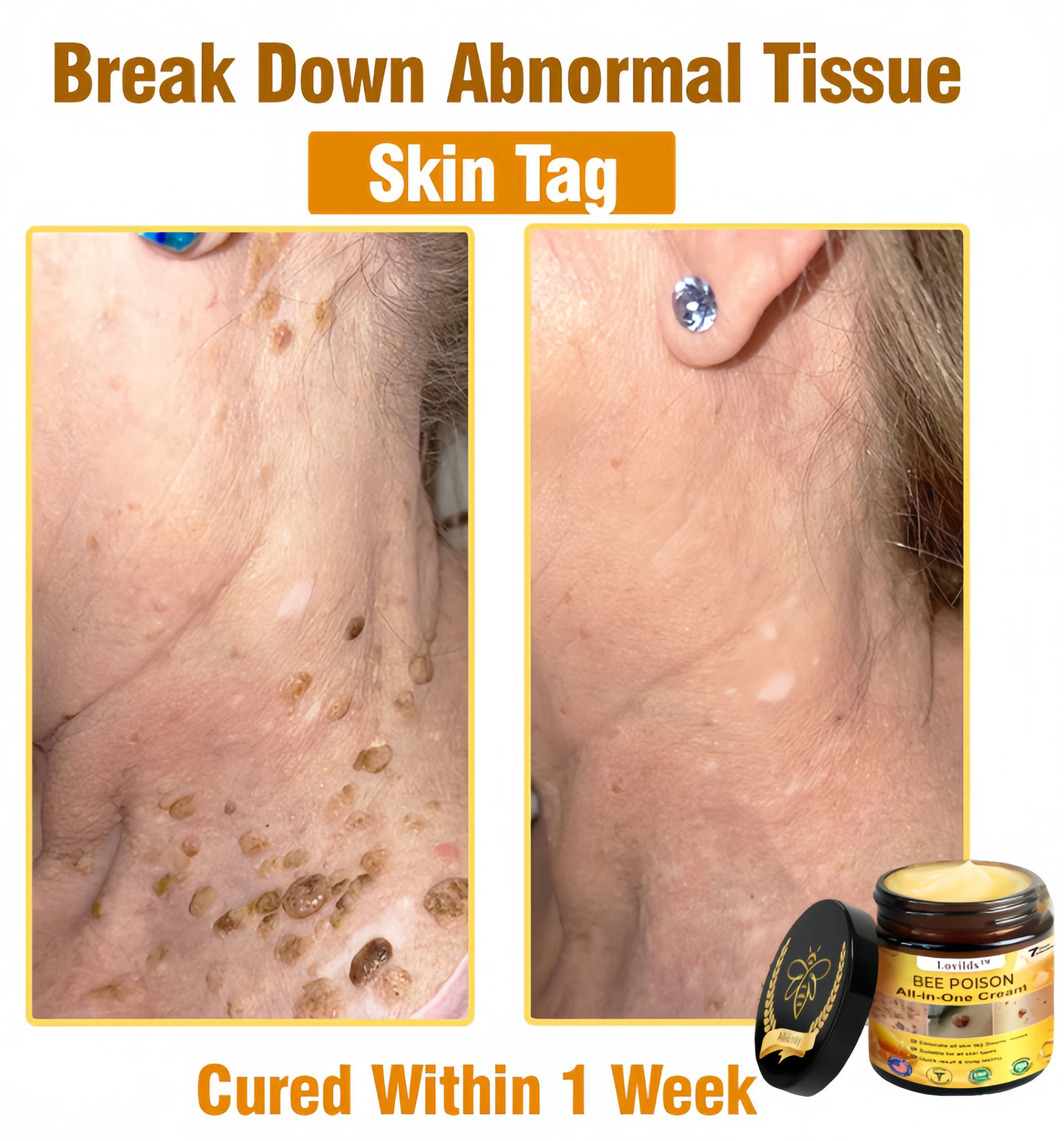 [Official Brand Store] 🏆Lovilds™ BEE POISON All-in-One Cream (✅FDA Approved & Mayo Clinic Recommended)