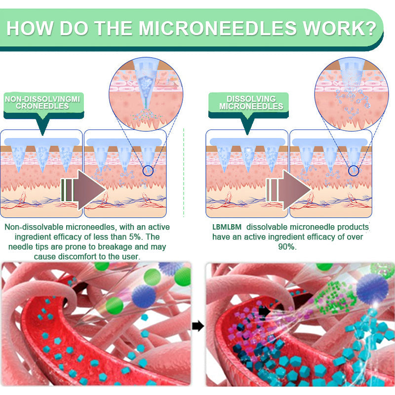 【Last Day Promotion 80% OFF🔥】Newyuo™ NIDDK-Tirzepatide Slimming & health NANO MICRONEEDLE PATCH🇺🇸👨‍⚕️（Zero Pain, 24/7 Release | Lose 20lbs FAST | 90% Sugar Drop | ）🔥🎁