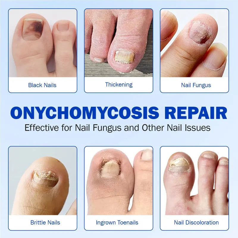 🔥Nail Health Care Patches – Repair and Strengthen Weak Nails Up to 65% OFF!