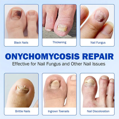 🔥Nail Health Care Patches – Repair and Strengthen Weak Nails Up to 65% OFF!