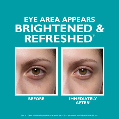 ✨LOVILDS™ Skinjection Fill+Fix Under-Eye Cream. Target Dark Circles, Puffiness & Fine Lines for a Youthful, Radiant Look