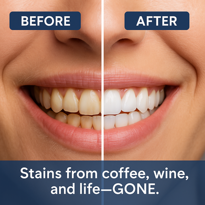 🏆【Max】 Newyuo® Nicotinamide Toothpaste【💎New upgrade Powerful type 10% concentration of Nicotinamide】